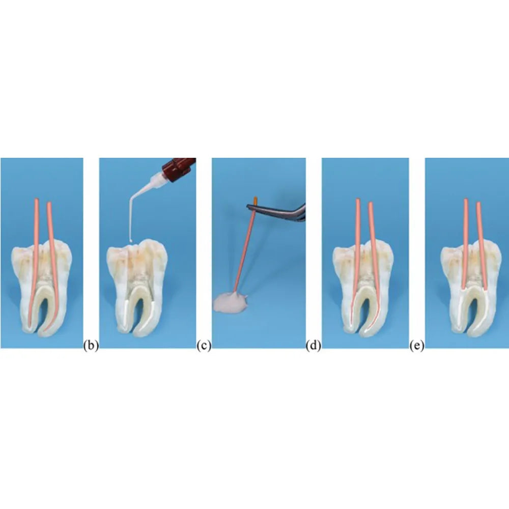 Meta CeraSeal RC Sealer