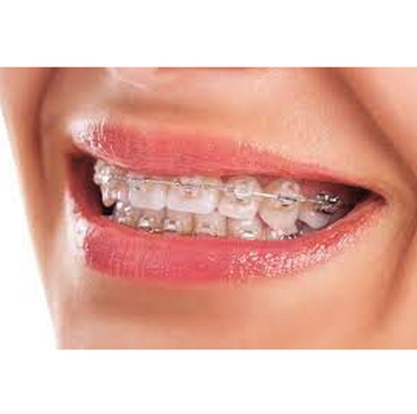 Metro Orthodontics 50 grams Ligature Wires