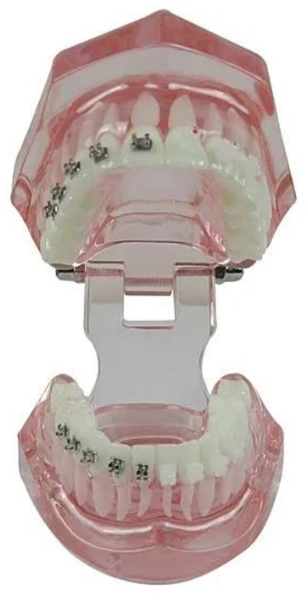 Metro Orthodontics Beggs Series Light-wire Bondable Contoured Metal Conventional Brackets