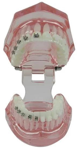 Metro Orthodontics Beggs Series Light-wire Weldable Flat Metal Conventional Brackets