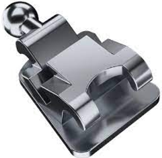 Metro Orthodontics New Simplified Lingual Brackets