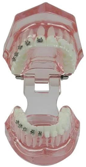 Metro Orthodontics Pink Series Upper/Lower 3-3 022 Ceramic Conventional Brackets