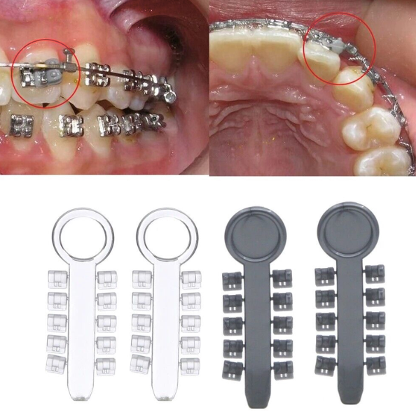 Metro Orthodontics Rotation Wedges Orthodontic Accessory