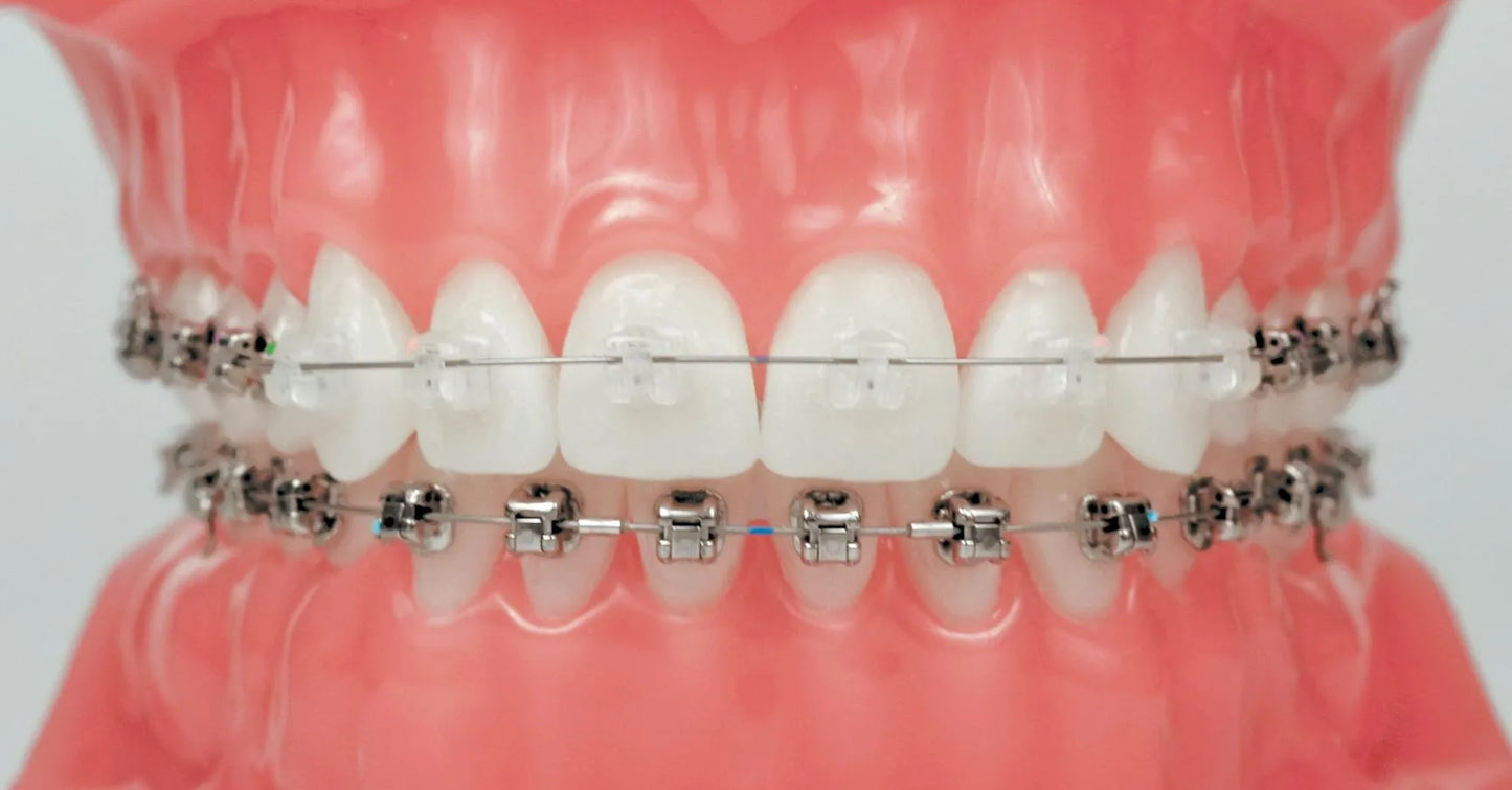 Morelli Niti Archwire Set for SL Brackets (SLB)