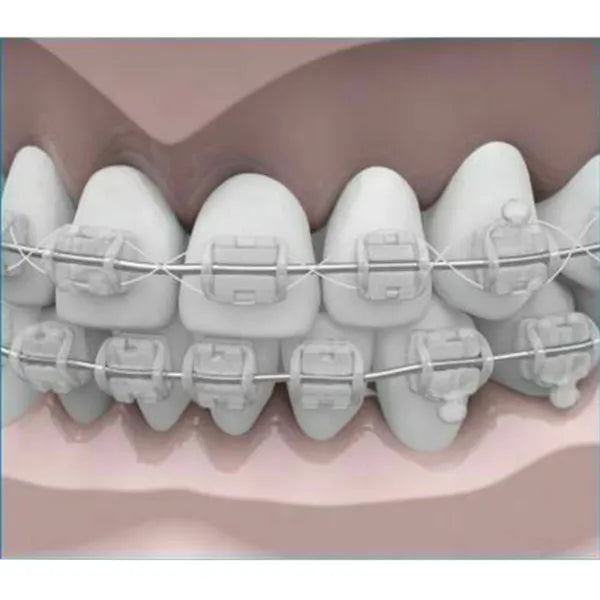 Morelli Tooth Colour Ligature Wire Ø0.25mm (.010 ") in Roll Spool 10m - 5501220