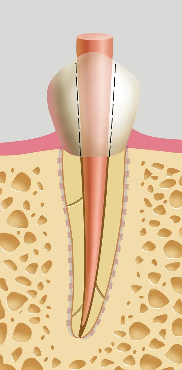 NeoEndo Protaper Gutta Percha Points