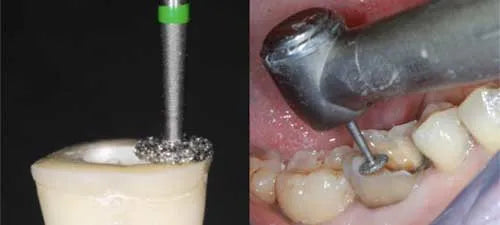 NewDiamond Wheel Round Diamond Bur -WR (Pack Of 3)