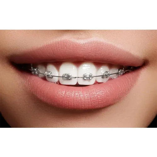 OSL Heat Activated NiTi Ovoid Form Archwires Rectangular