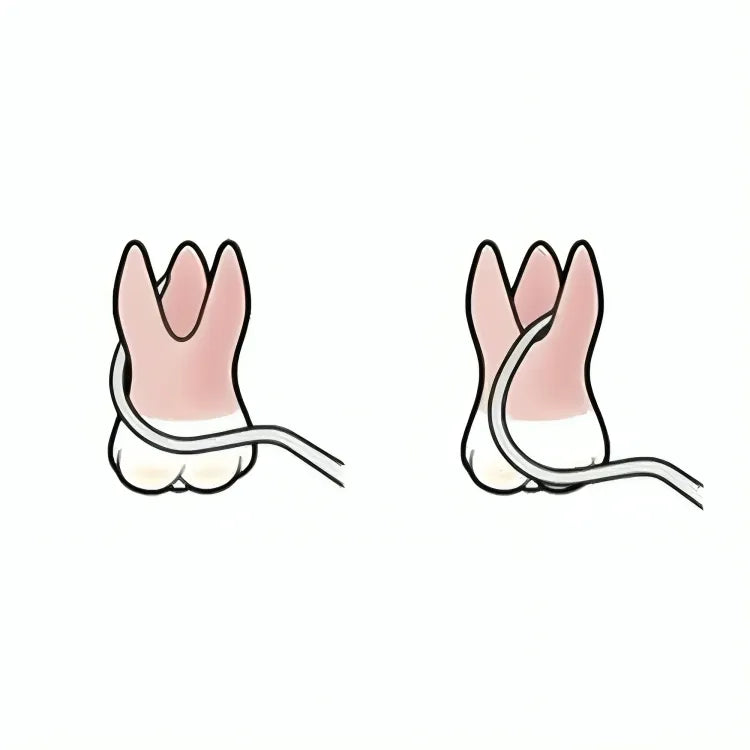 Oracraft Periodontal Probes
