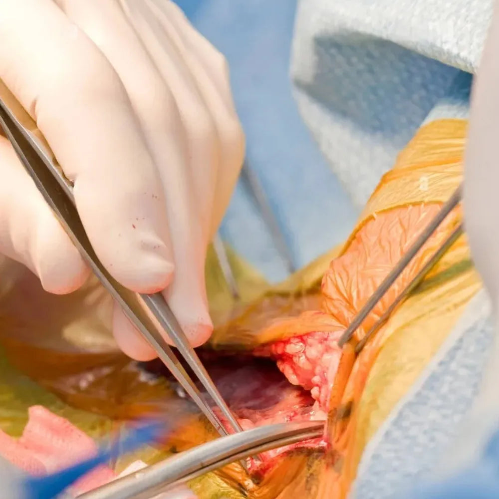 Oracraft Tissue Pliers