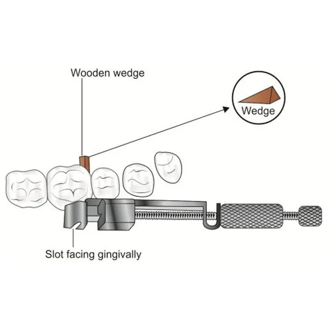 Oracraft Tofflemire Matrix Retainer - MRTU