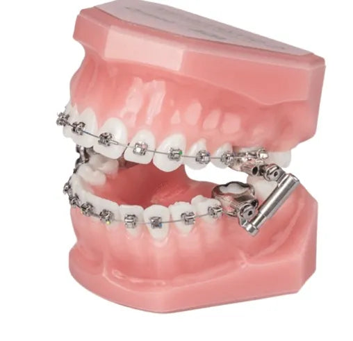 Ormco Advancsync 2 Class II Corrector