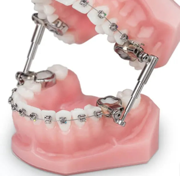 Ormco Advancsync 2 Class II Corrector