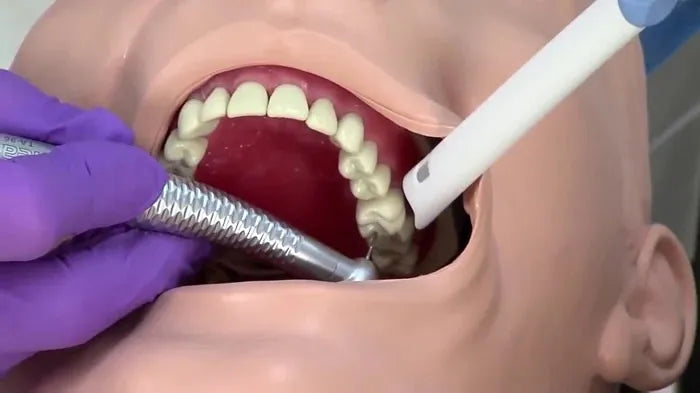 Oro Vented Oral Evacuation Tips