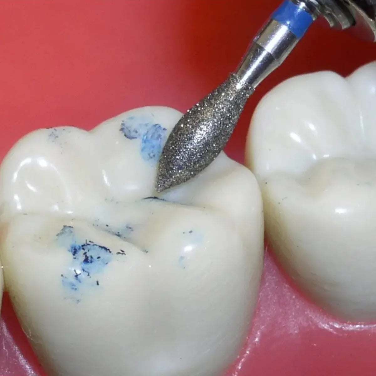 Pivo Best All - Round Airotor Burs Kit (Set Of 15)