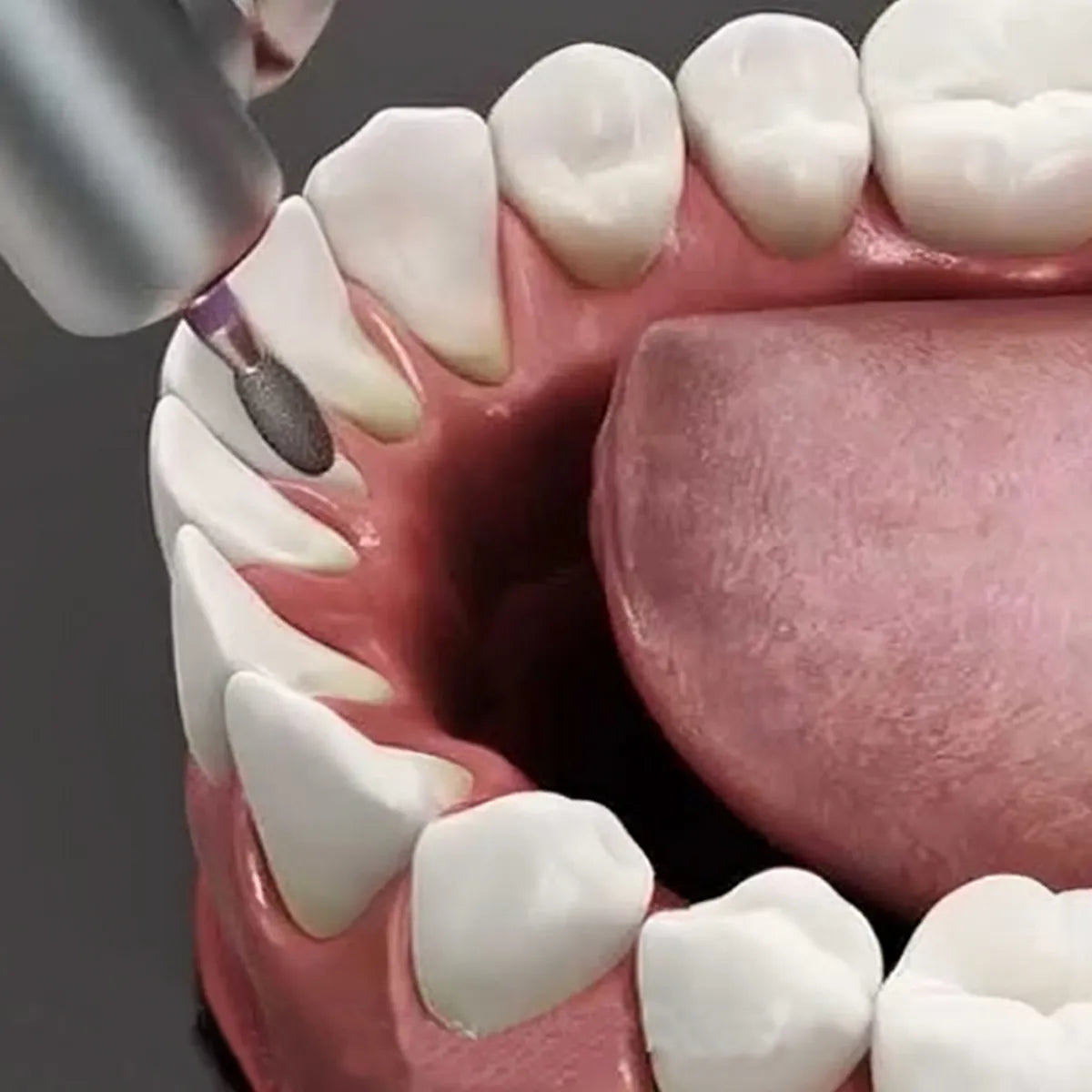 Pivo Best All - Round Airotor Burs Kit