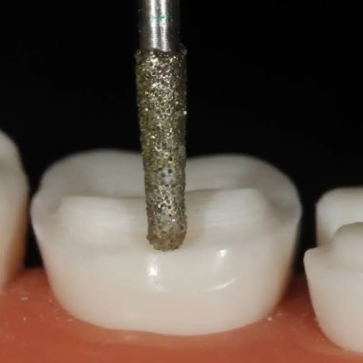 Pivo Inlay - Onlay Preparation Diamond Burs Kit (Set Of 8)