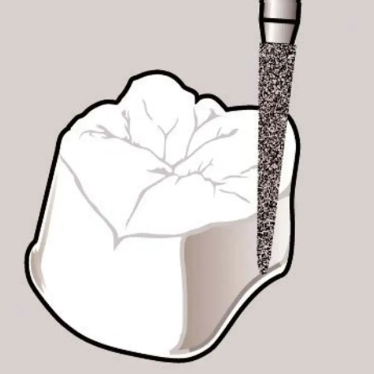 Pivo Taper Conical End CA Diamond Burs