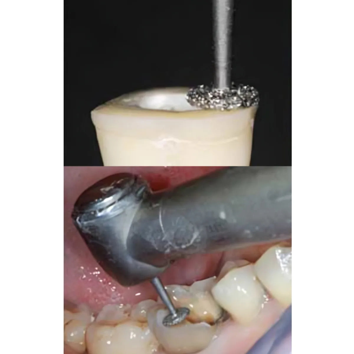 Pivo Wheel Round CA Diamond Burs - WR-13 (Pack Of 5)