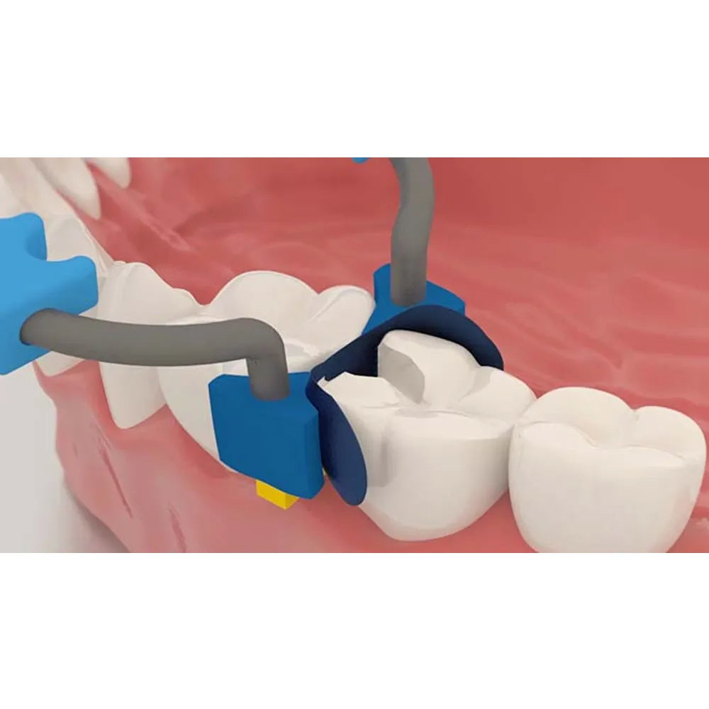 Polydentia MyQuickmat Classico Sectional Matrix Kit & Refills