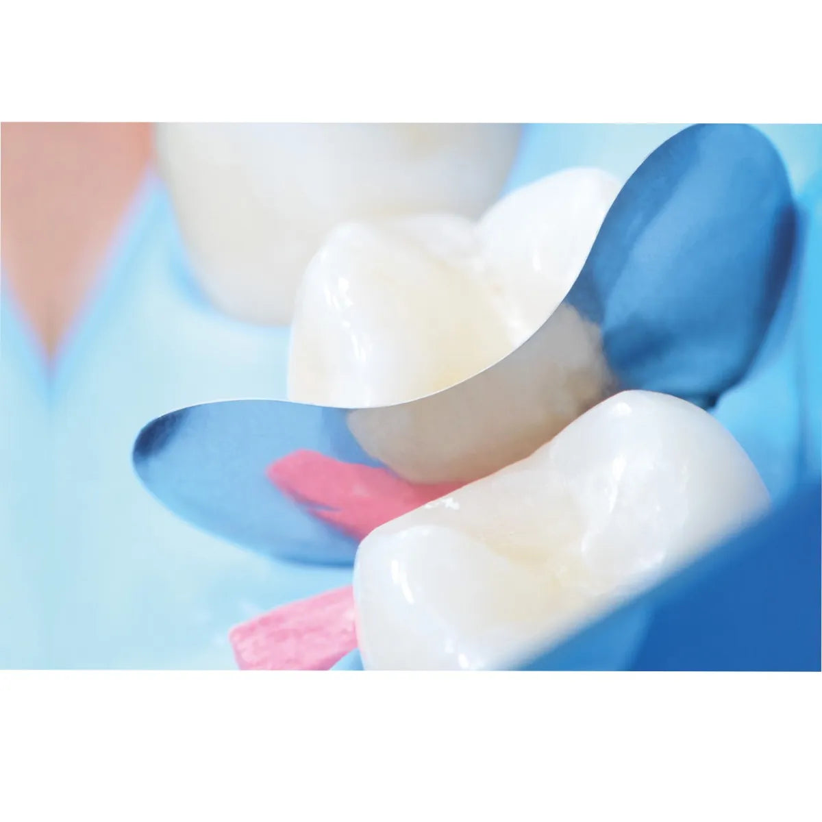 Polydentia QuickmatFLEX Sectional Matrices