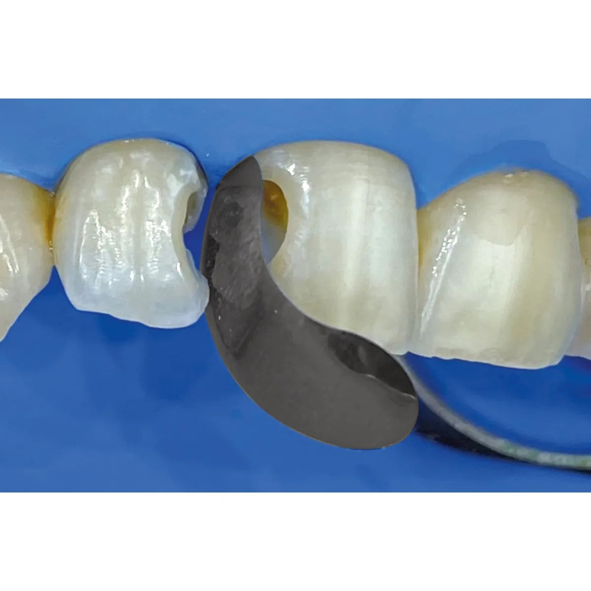 Polydentia QuickmatFLEX Sectional Matrices