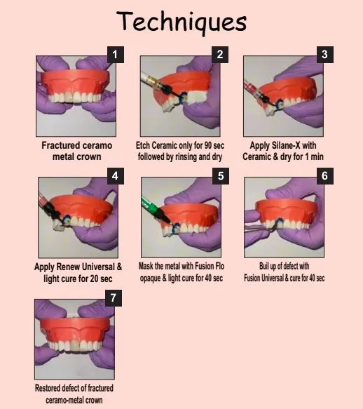 Prevest A.C.E Ceramic Repair Kit