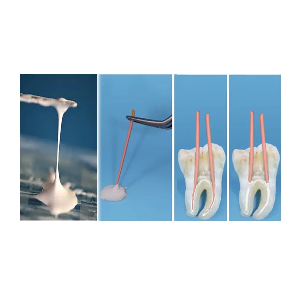 Prevest Denpro CalAPex Root Canal Sealer Manual Mix (40041-2)