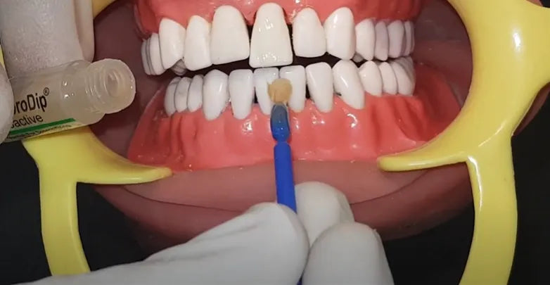 Prevest Denpro FluoroDip Bioactive