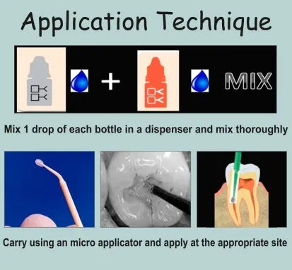 Prevest Denpro Fusion Bond Dc