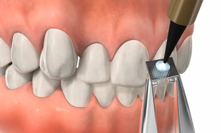 Prevest Denpro Fusion Crysta Adhesive - Trial Pack (10022)