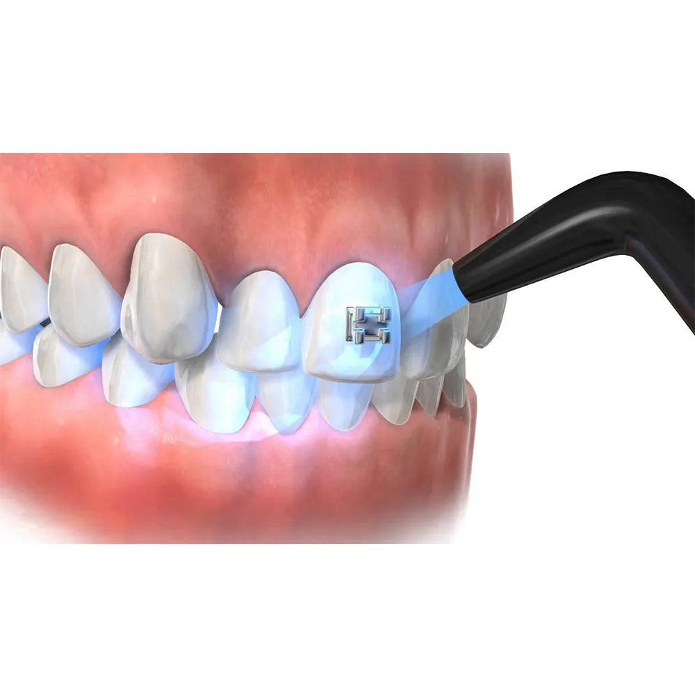 Prevest Denpro Fusion Crysta Adhesive Primer - Regular Pack (10021)