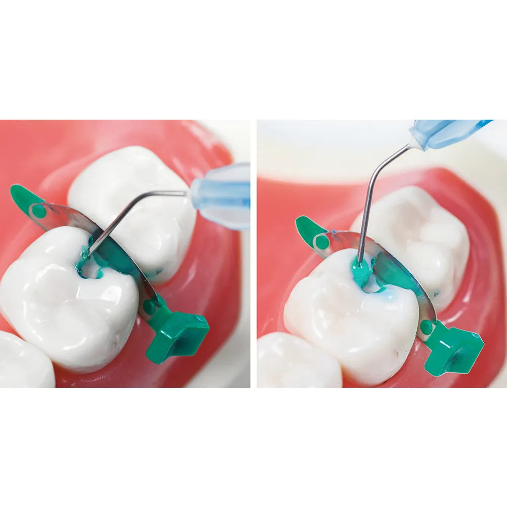 Prevest Denpro Microgel SF