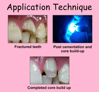 Prevest Fusion Core Dc Flo (9gm)