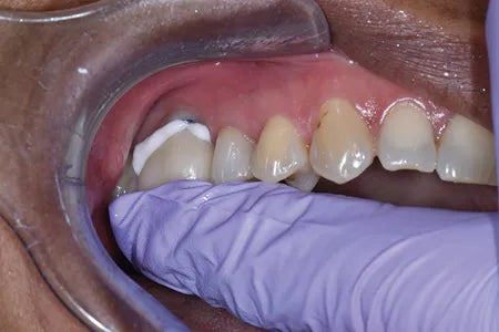 Prevest Fusion Self Lute