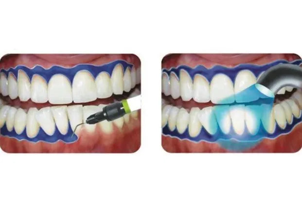 Prevest Gingiva Shield Vlc