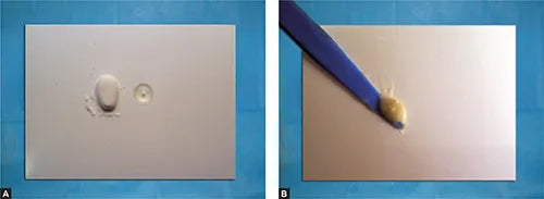 Rubydent RubyGlass F Glass Ionomer Restorative Cement