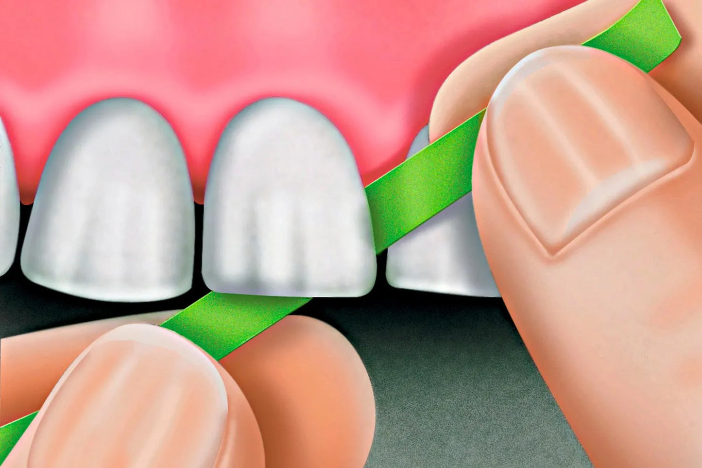 Rubydent RubyPlaton Polishing Strips