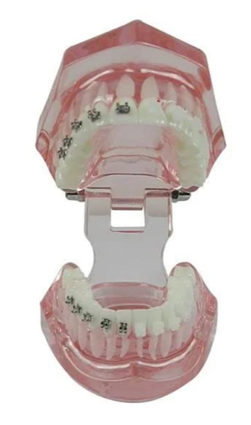 Metro Orthodontics Box of 240 Plain Adult Orthodontic Bands