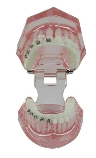 Metro Orthodontics Box of 240 Plain Pedo Orthodontic Bands