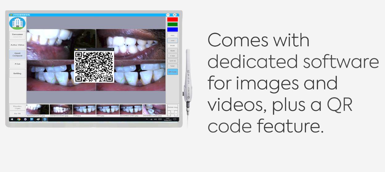Qualdent Intra Oral Camera With Touch Screen - All In One Computer