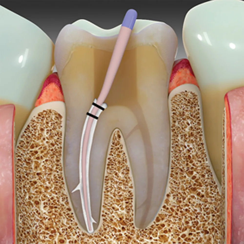 Septodont Bio Root RCS