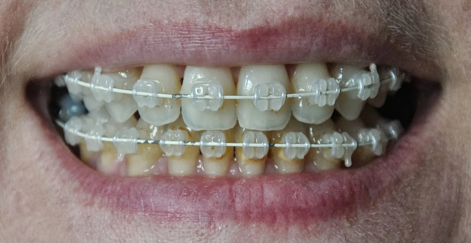 U Ortho SS Tooth Color Wire - Rectangular