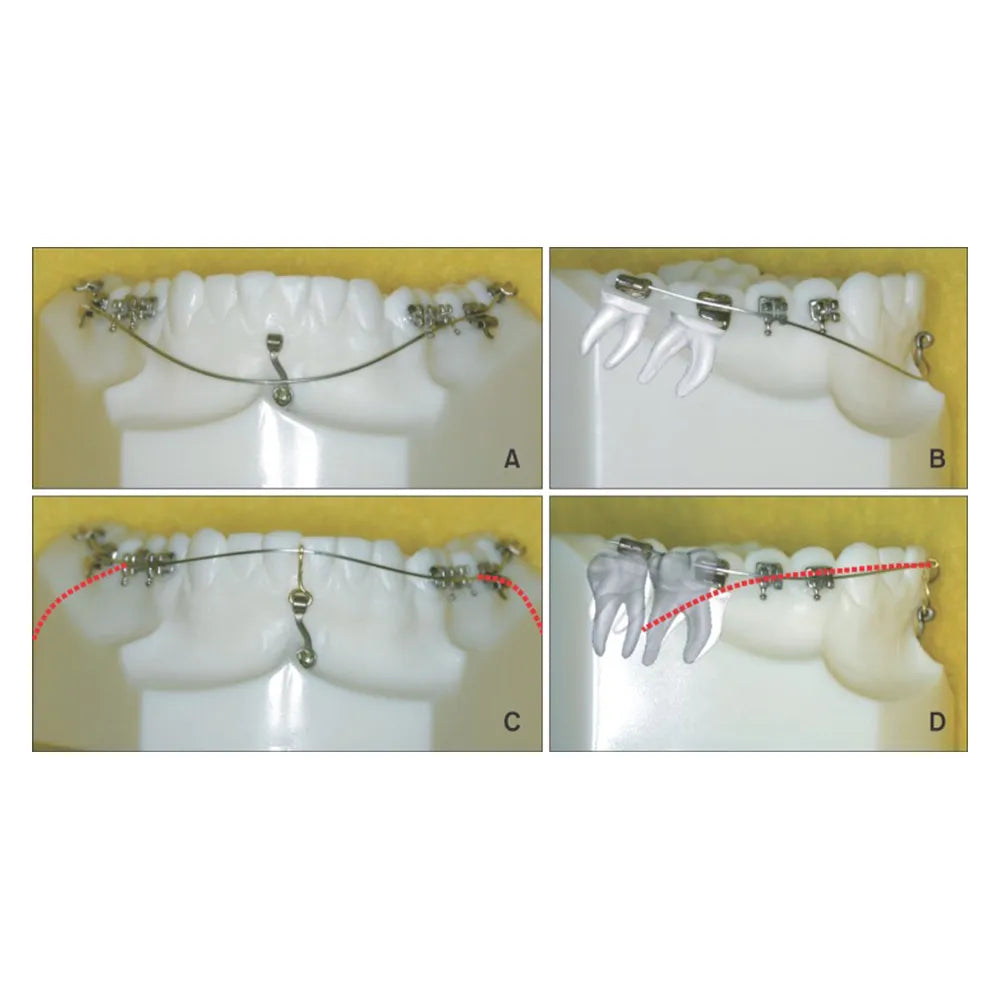 U ortho Niti Reverse Curve Arch Wire-Ovoid
