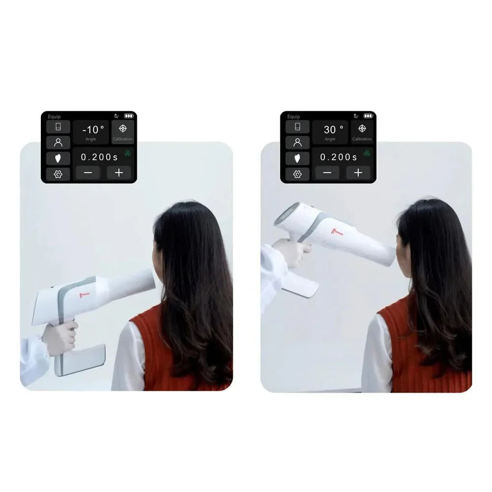 Woodpecker Ai Ray Portable X-Ray Machine