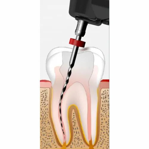 Woodpecker Endomatic Endomotor