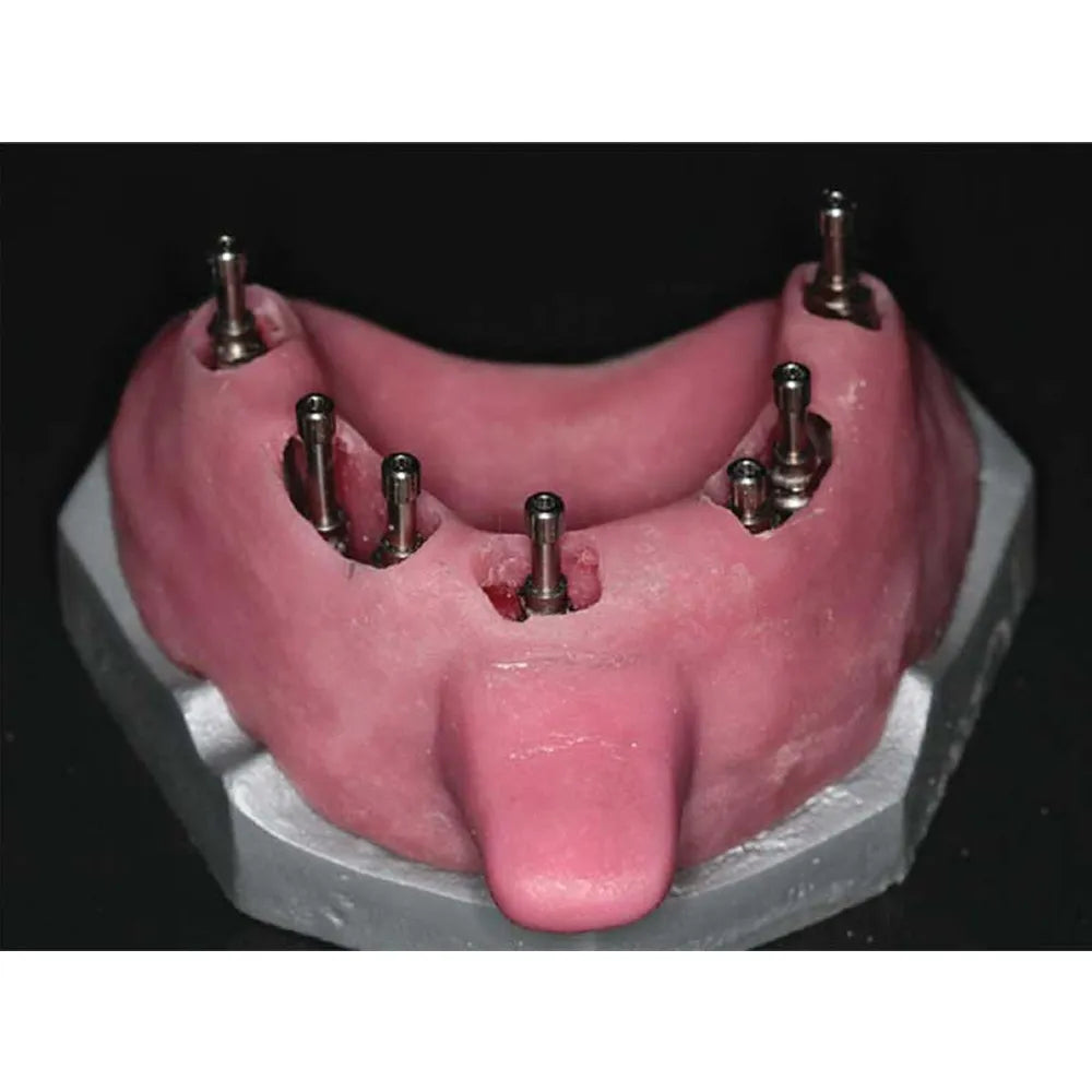 Xcem Conical Pick Up Impression Coping - Non Hex
