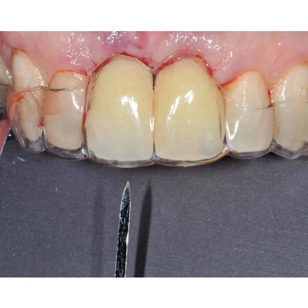 Xcem Dental Implant Guide Drill 2mm (XGDR20B)