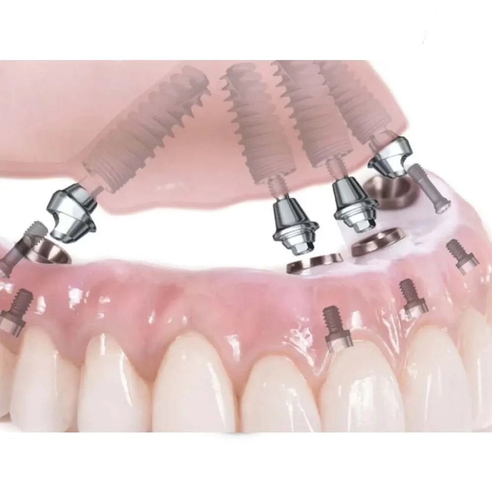 Xcem Dental Implant Submerged Conical Multi Unit Abutment Mini