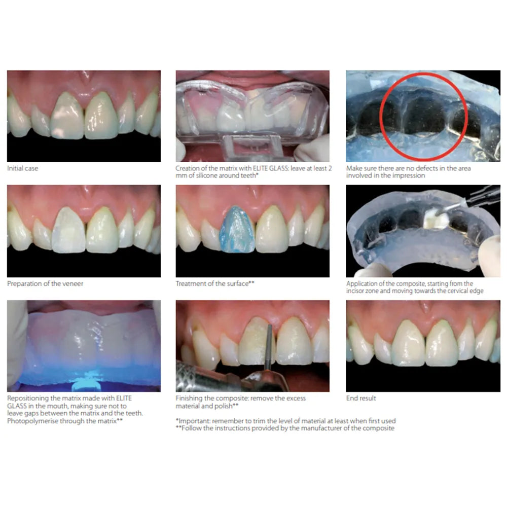 Zhermack Elite Glass (C401610)